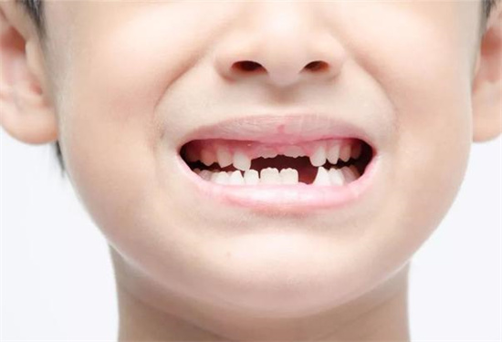 儿童换牙的年龄是多大-图2