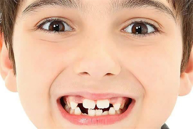 孩子五岁换牙正常吗 五岁孩子换牙齿正常吗-图1